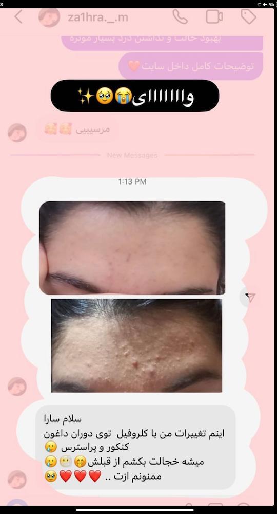 slide-image-undefined